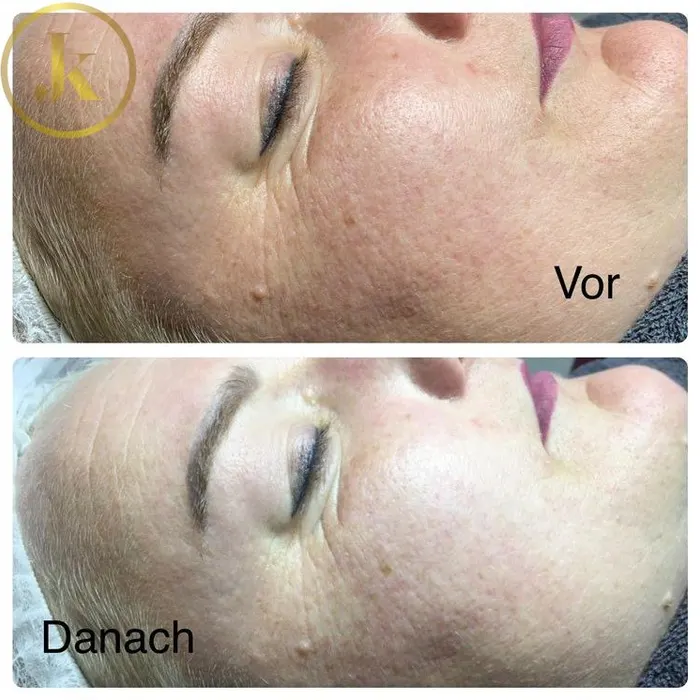 Augen & Augenbrauen – Aufnahme 17
