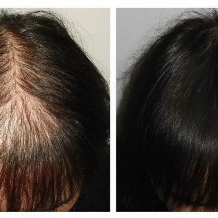 Haare – Aufnahme 2