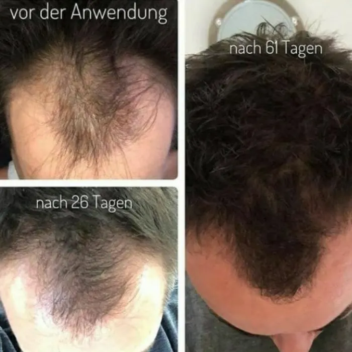 Haare – Aufnahme 3