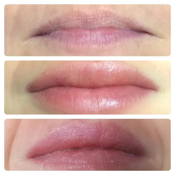 Lippen – Aufnahme 1
