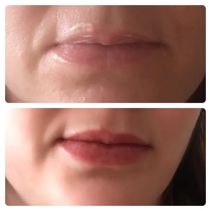 Lippen – Aufnahme 2