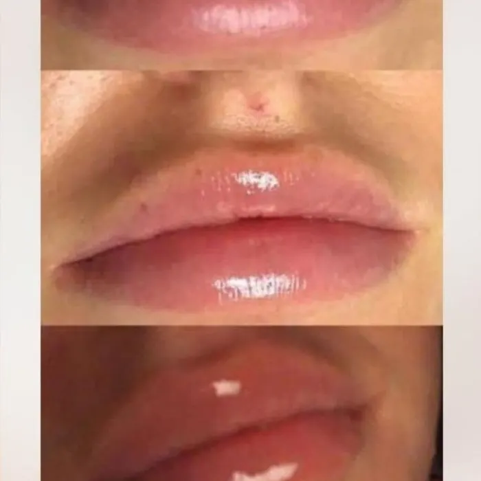 Lippen – Aufnahme 5